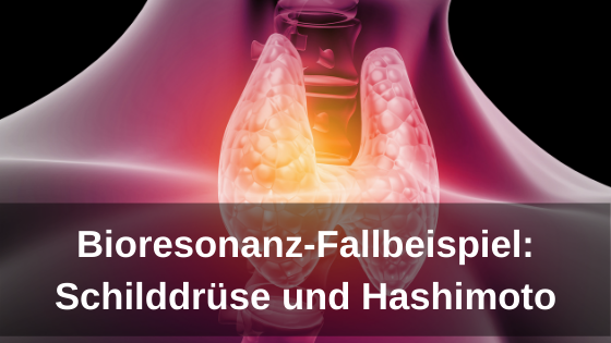 Bioresonanz-Fallbeispiel: Schilddrüse und Hashimoto