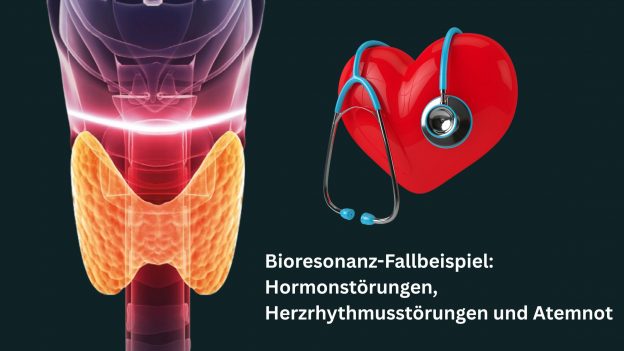 Bioresonanz Fallbeispiel: Hormonstörungen, Herzrhythmusstörungen und Atemnot
