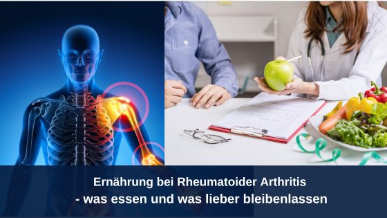 Ernährung bei rheumatoider Arthritis - was essen und was lieber bleibenlassen