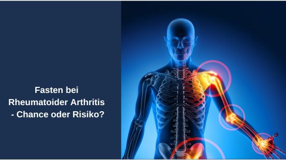 Fasten bei rheumatoider Arthritis – Chance oder Risiko