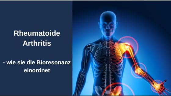 Rheumatoide Arthritis – wie sie die Bioresonanz einordnet