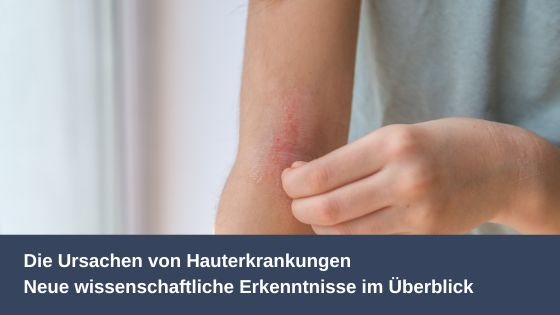 Die Ursachen von Hauterkrankungen: Neue wissenschaftliche Erkenntnisse im Überblick