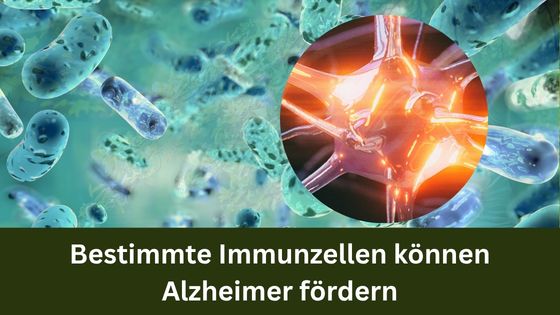 Bestimmte Immunzellen können Alzheimer fördern