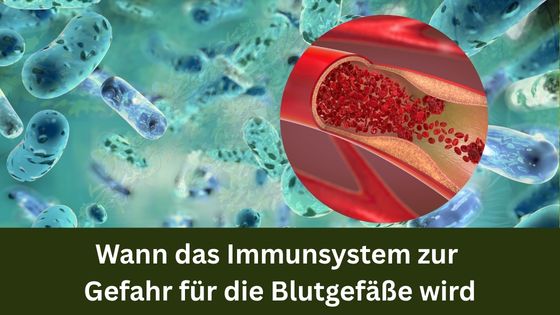 Wann das Immunsystem zur Gefahr für die Blutgefäße wird